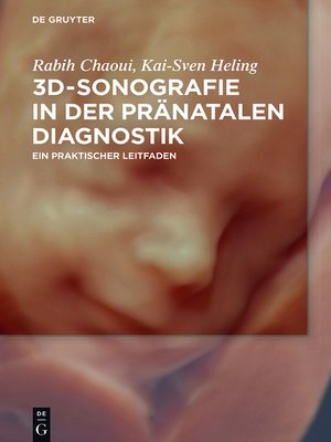cover image of 3D-Sonografie in der pränatalen Diagnostik
